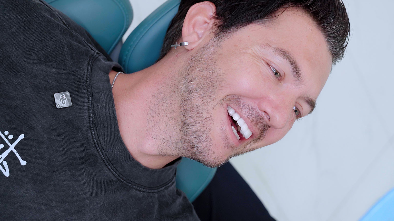 Final smile after dental crowns in Vietnam